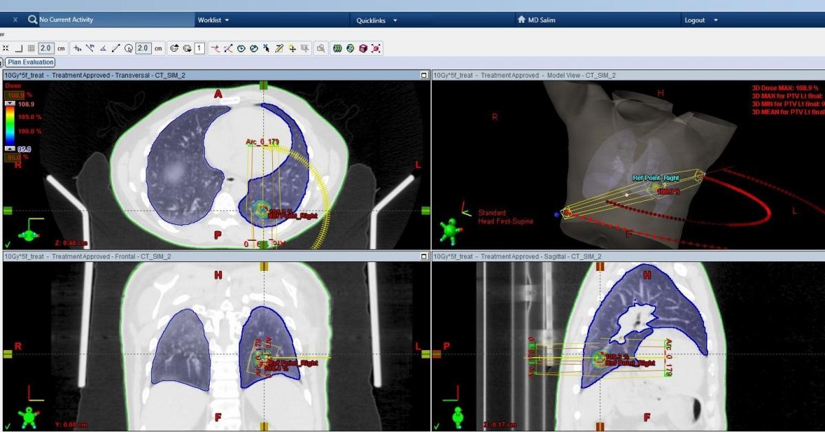 lung cancer treatment in Moscow