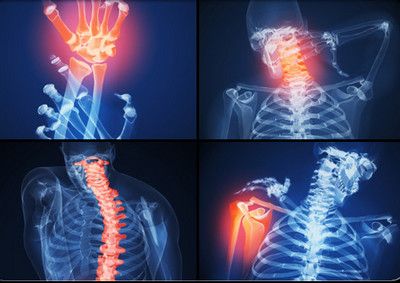 rheumatoid arthritis treatment