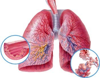 Make an appointment with a pulmonologist