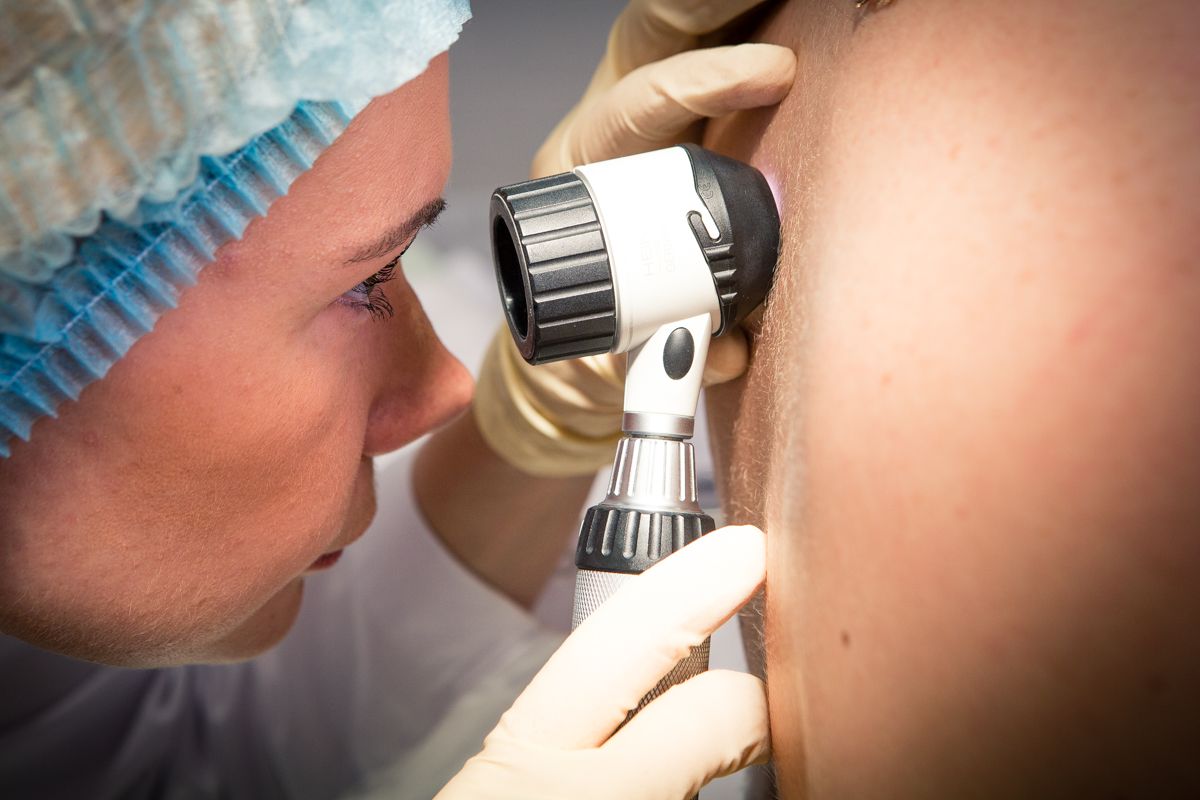 Treatment of basal cell carcinoma in Moscow