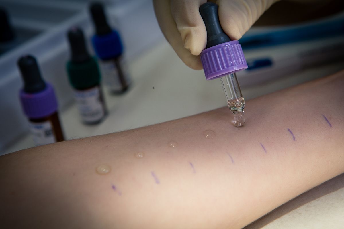 Pollinosis treatment, allergy pollinosis treatment