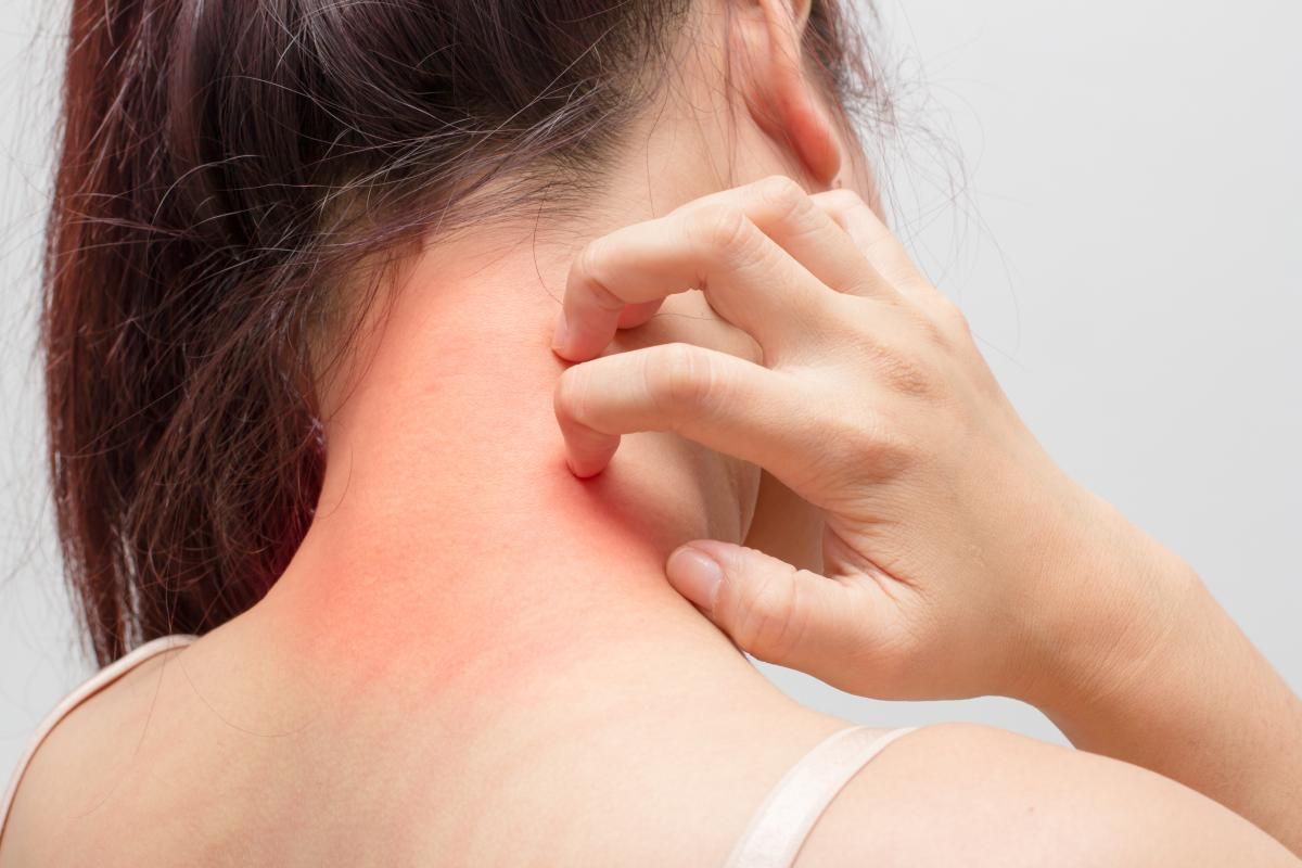 treatment of atopic dermatitis in the clinic, atopic dermatitis