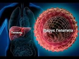  Hepatitis C treatment in Moscow