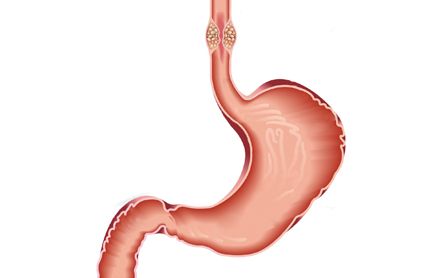 esophageal cancer treatment in Moscow