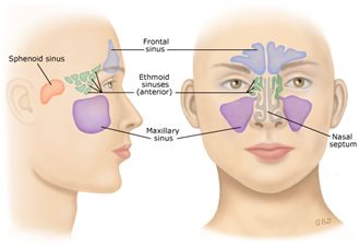 treatment of sinusitis in children, children's sinusitis treatment