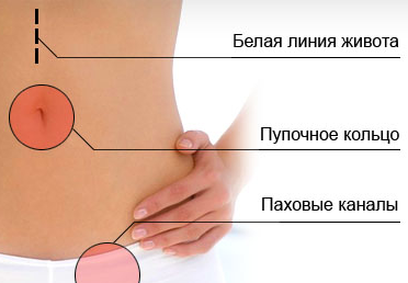 hernia treatment in adults