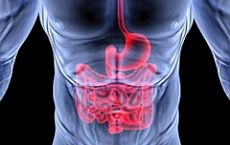 capsule endoscopy of the intestine