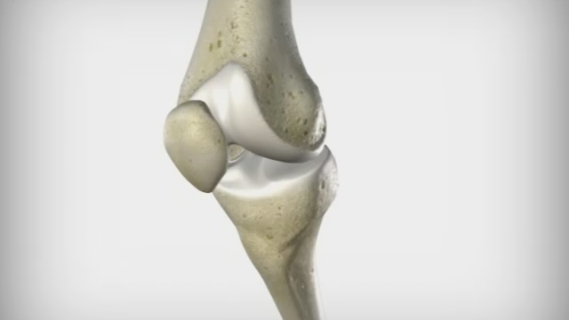 Knee arthroplasty at the EMC clinic