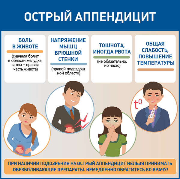 acute appendicitis