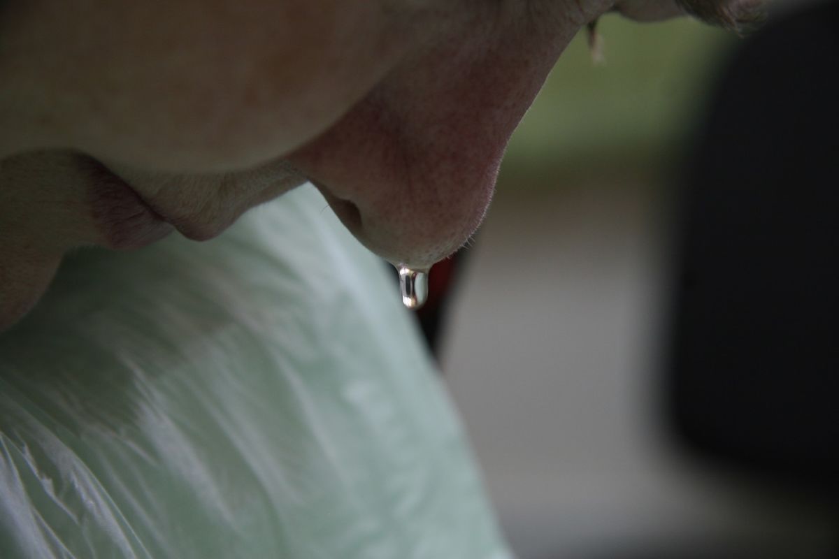 Symptoms of nasal liquorrhea