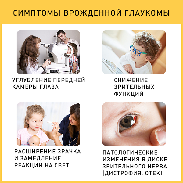 symptoms of glaucoma in children