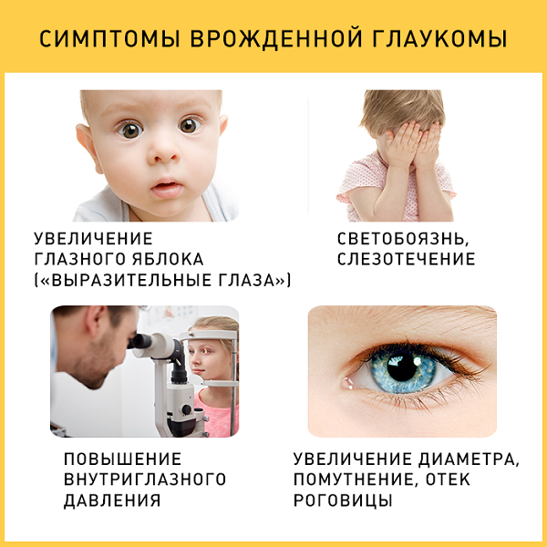 treatment of glaucoma in children