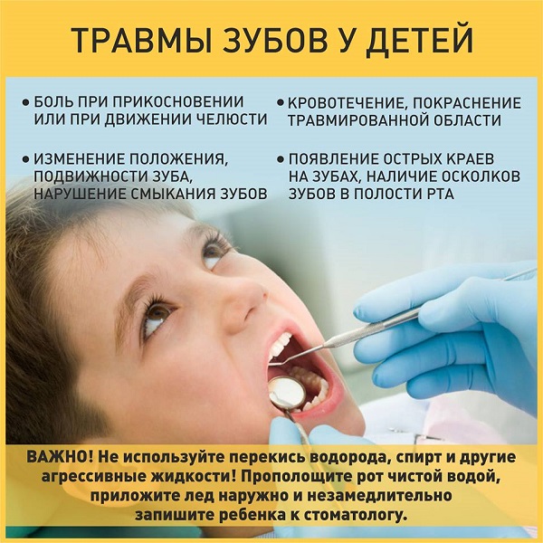dental injuries in children