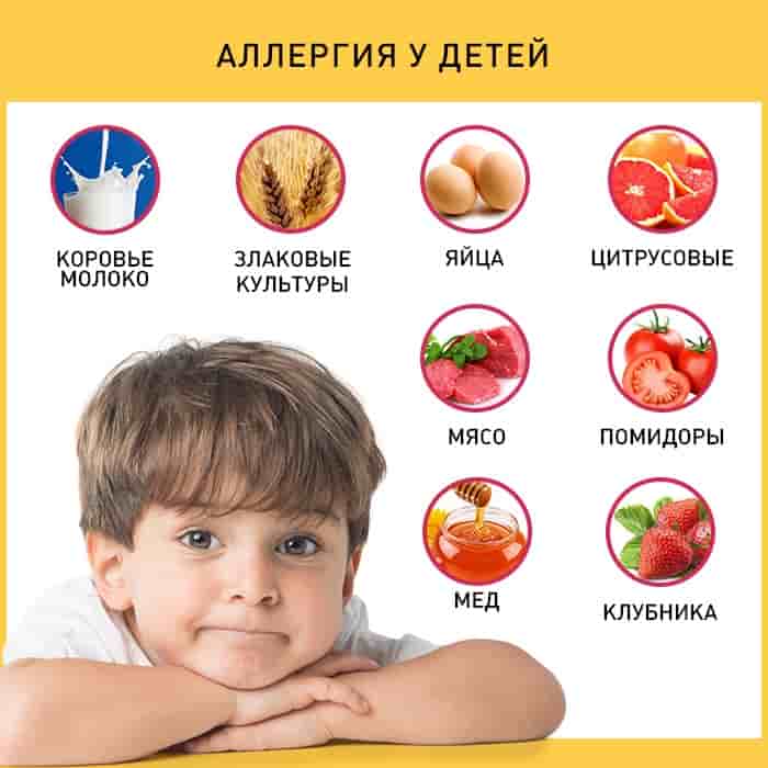 Allergies in children