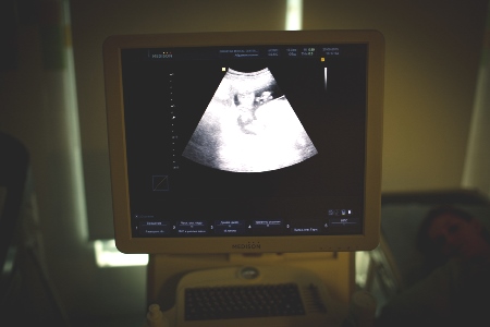infertility examination in Moscow