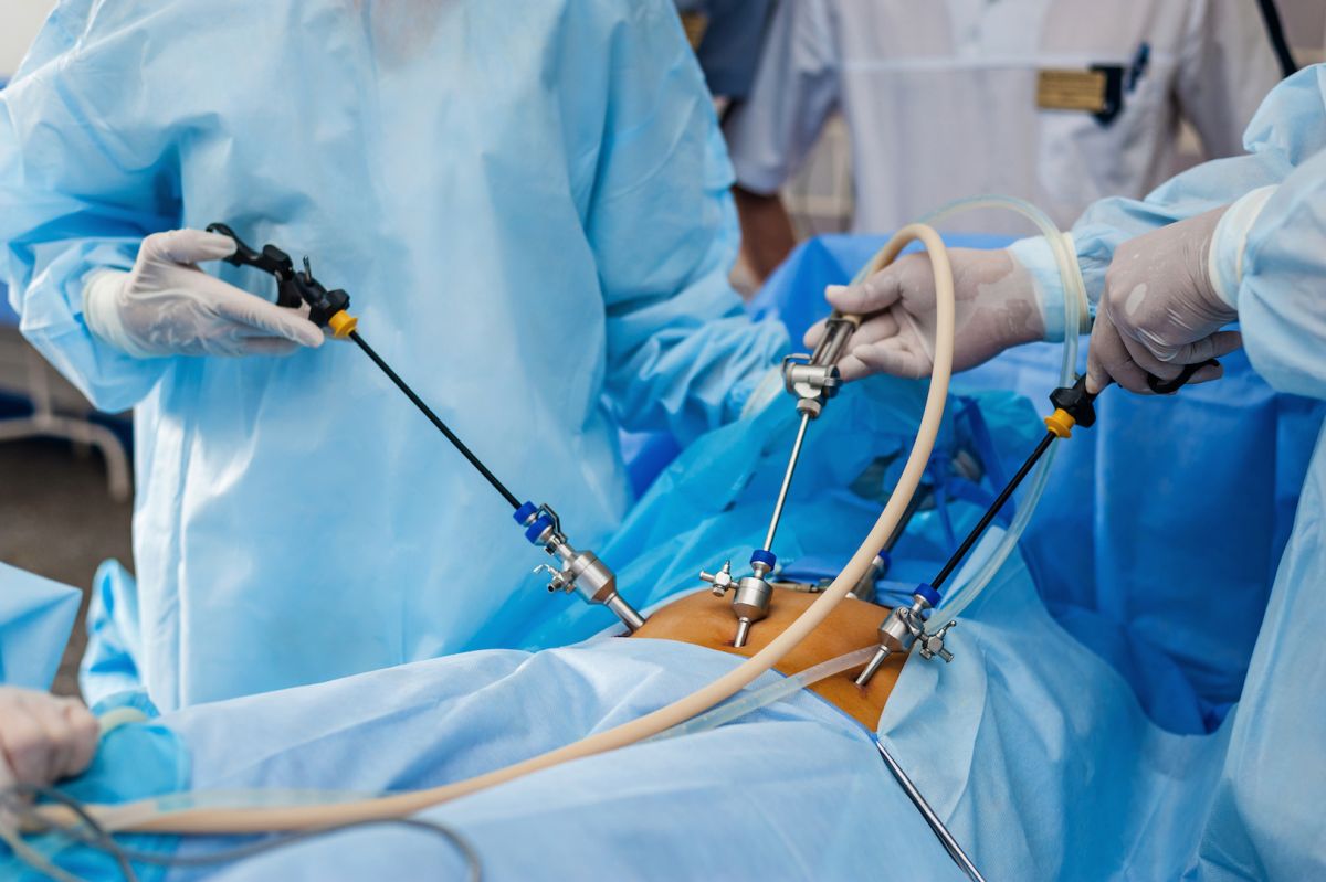 colon cancer surgery 