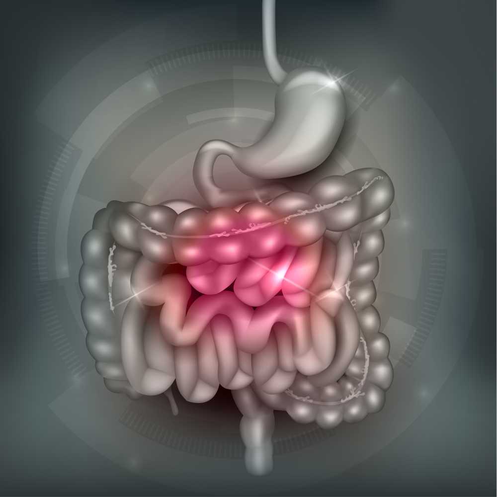 crohn's disease symptoms
