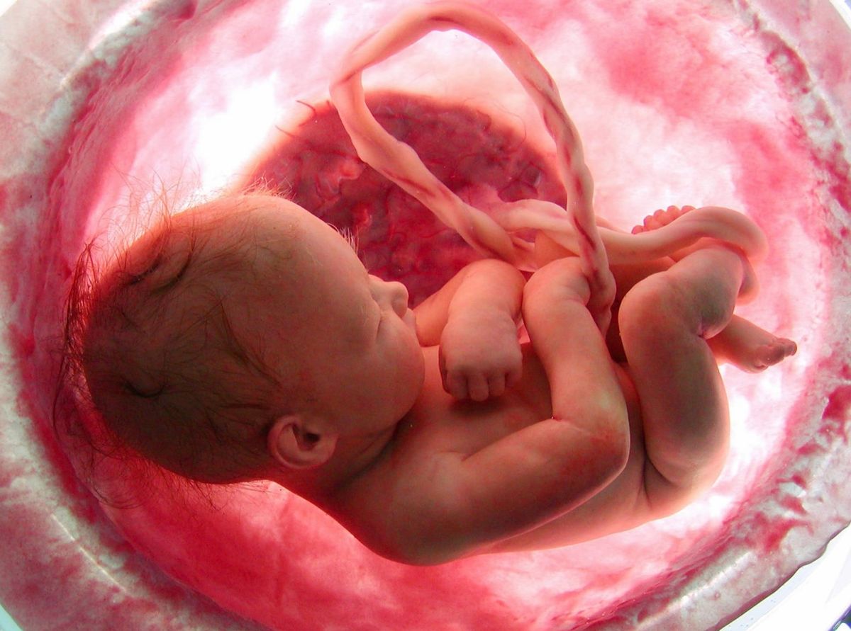 diagnosis of fetal hemolytic disease in EMC