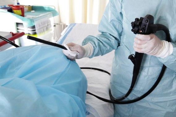 colon cancer symptoms 