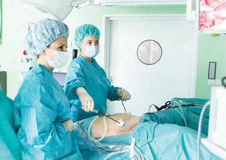 laparoscopic surgery