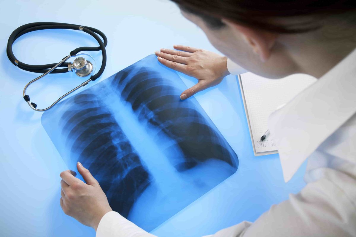 Get lung x-ray in Moscow