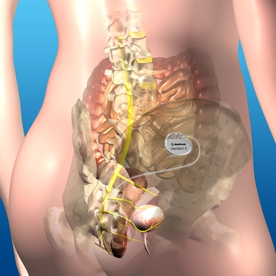 urinary incontinence treatment