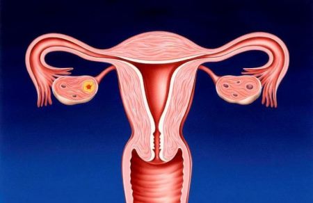 tubal infertility treatment in Moscow