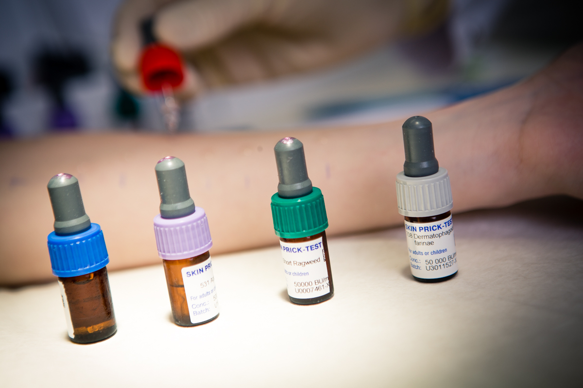 analysis of food intolerance in EMC, make an appointment with an allergist