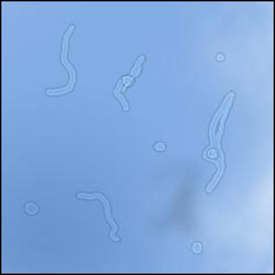 Vitreous body 2.JPG 