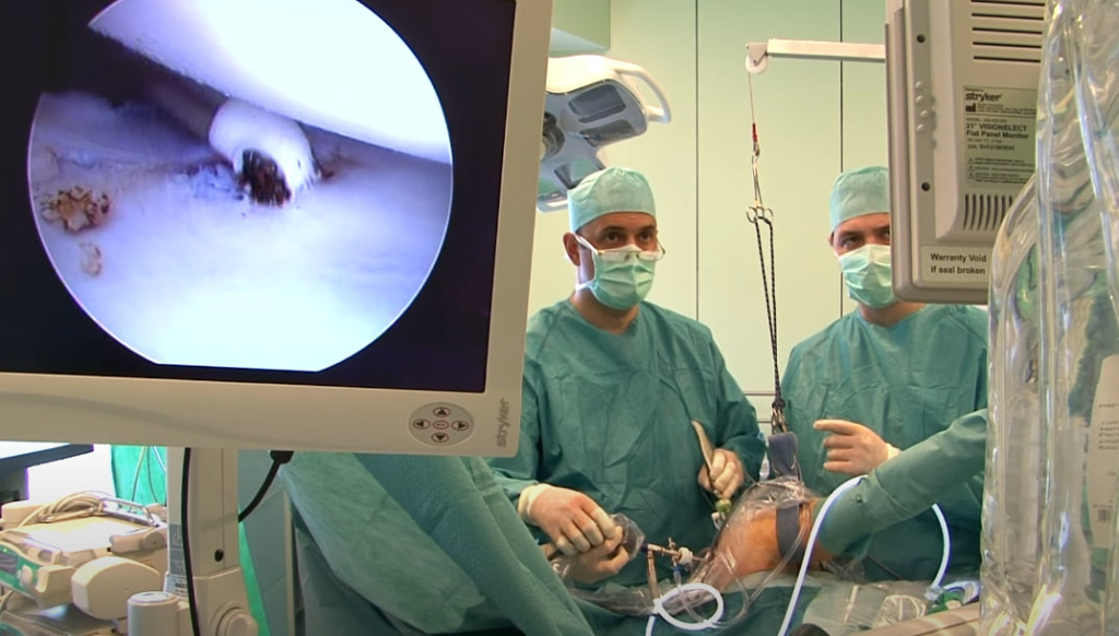 Lipoma removal