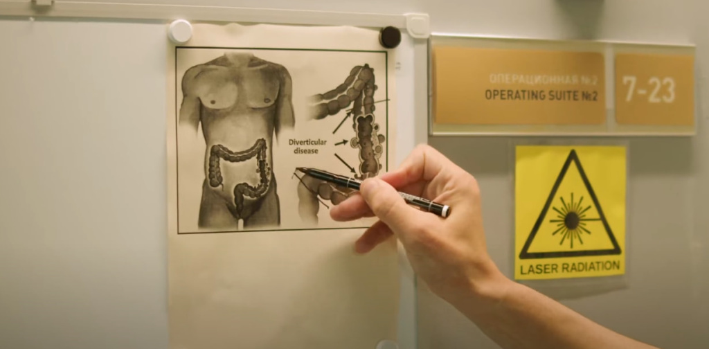 Rectal prolapse